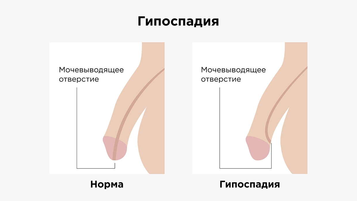 у маленького мальчика большой член (99) фото